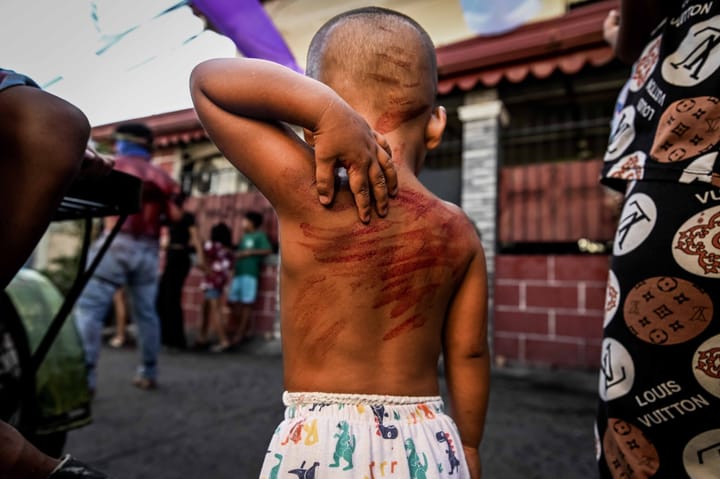 Angeles City files child abuse complaint vs parents of boy mimicking flagellation